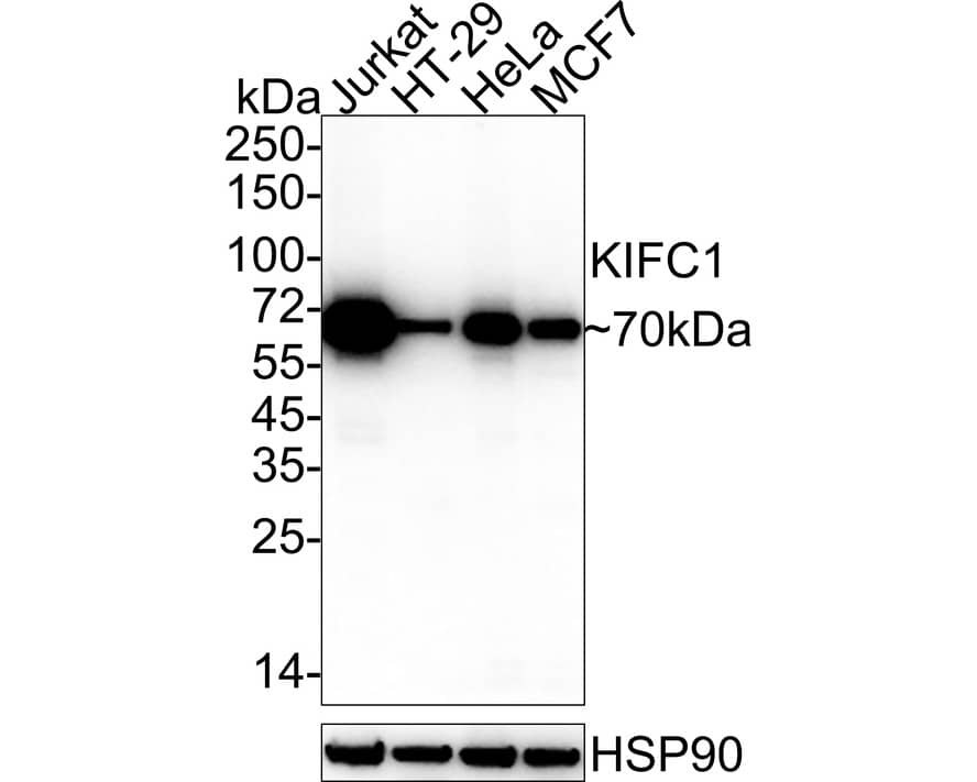 KIFC1 Antibody (JE00-46)