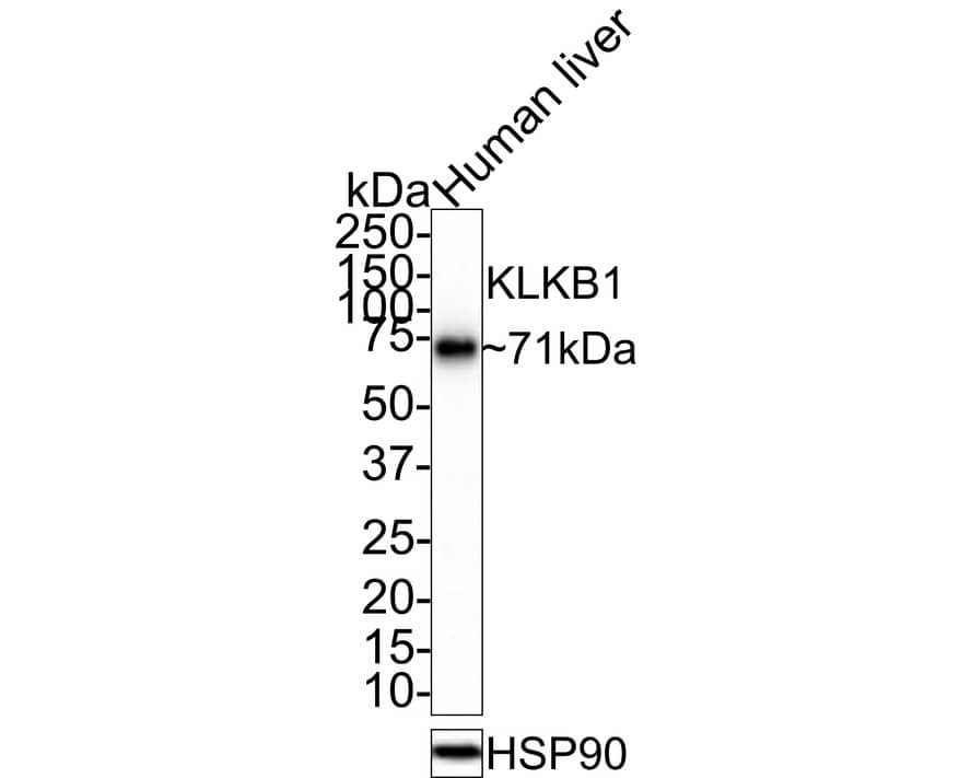 Plasma Kallikrein/KLKB1 Antibody (JE31-29)