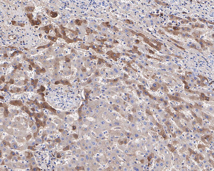 Plasma Kallikrein/KLKB1 Antibody (JE31-29)