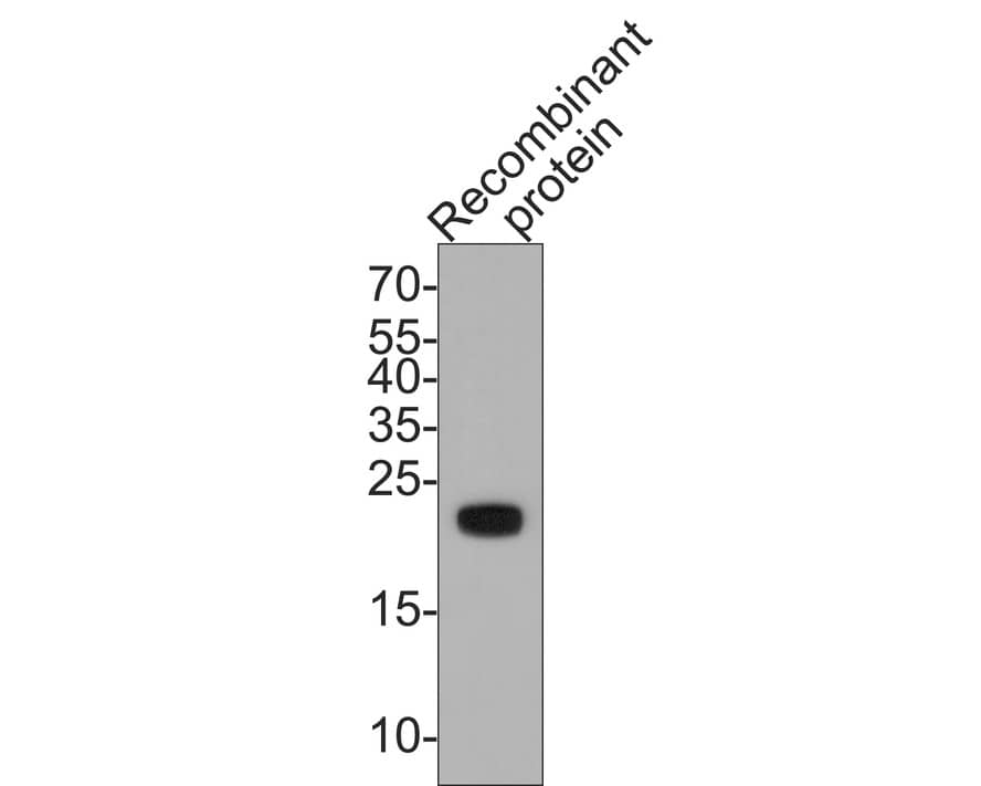 KMT2D Antibody