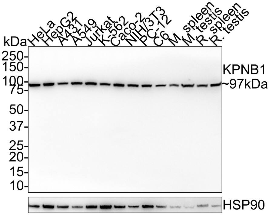 Importin beta/KPNB1 Antibody (PSH01-60)