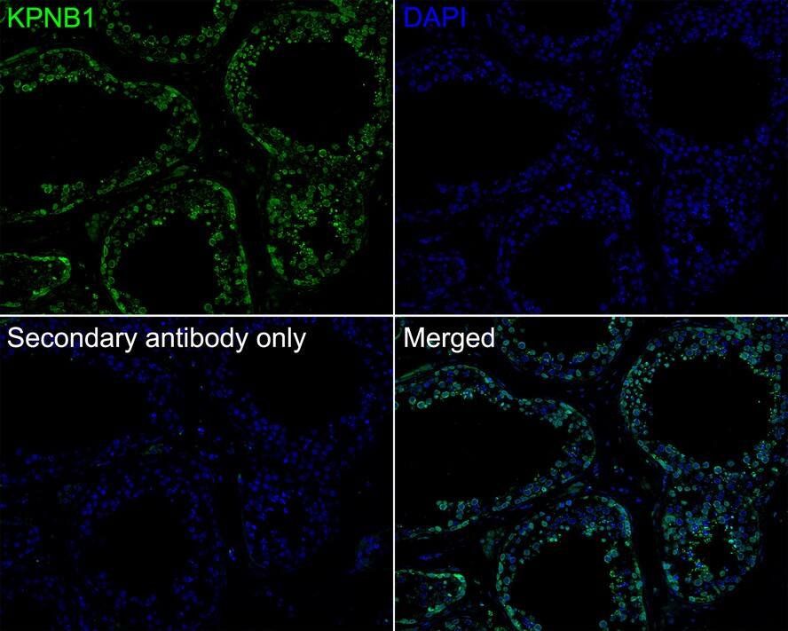 Importin beta/KPNB1 Antibody (PSH01-60)