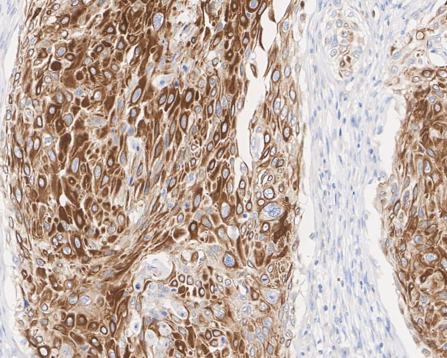 KSR1 Antibody (JE57-75)