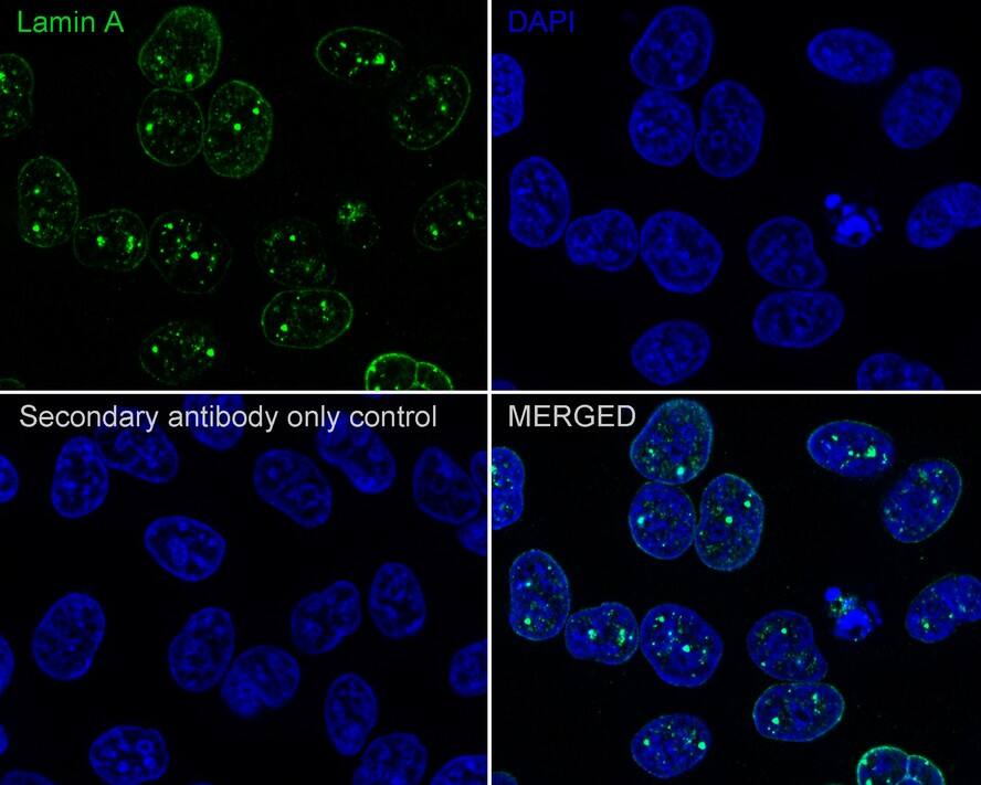 Lamin A + C Antibody (A6F5-R)