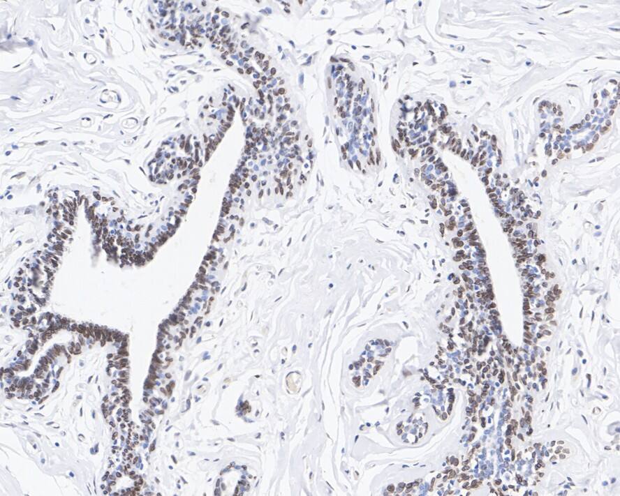 Lamin A + C Antibody (A6F5-R)