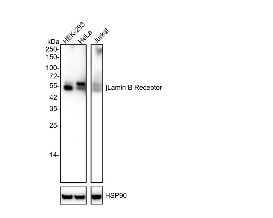 Lamin B Receptor Antibody (PSH02-93)