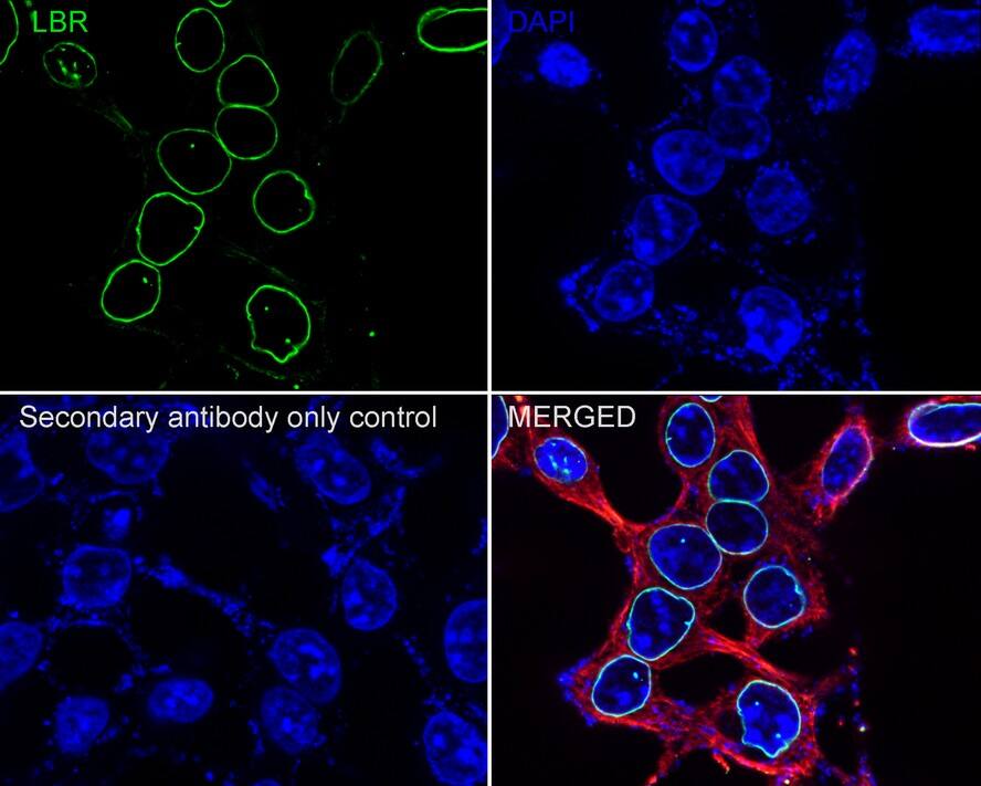 Lamin B Receptor Antibody (PSH02-93)