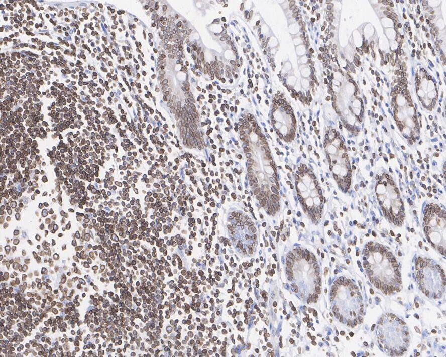 Lamin B Receptor Antibody (PSH02-93)