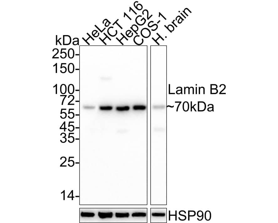 Lamin B2 Antibody (J9-C4-R)