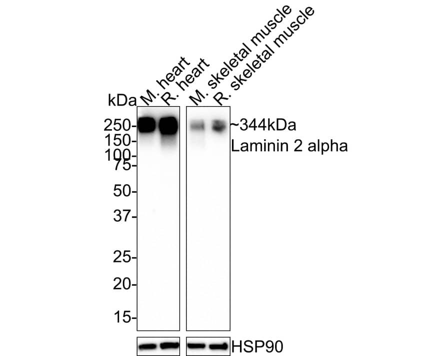 Laminin alpha 2 Antibody (PSH0-94)