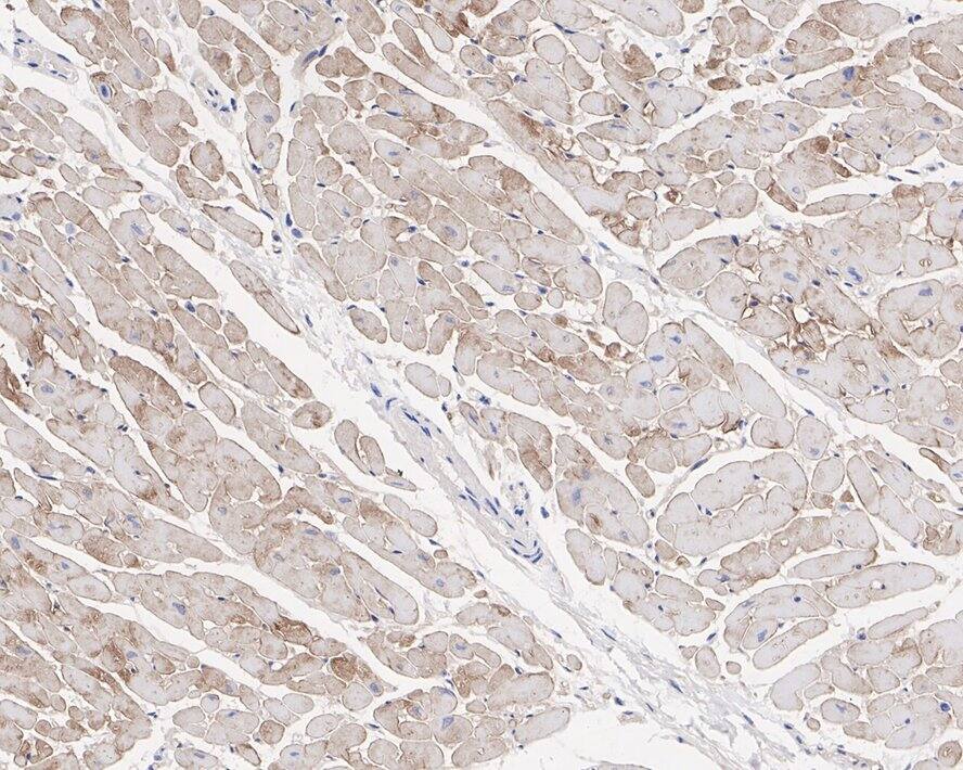 Laminin alpha 2 Antibody (PSH0-94)