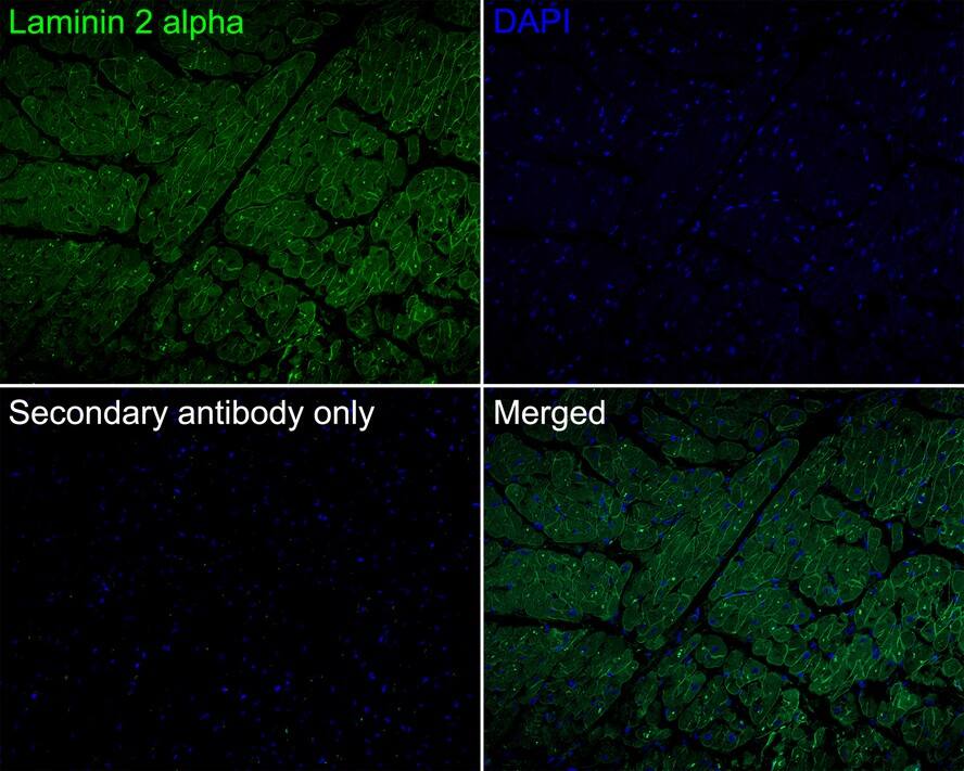 Laminin alpha 2 Antibody (PSH0-94)