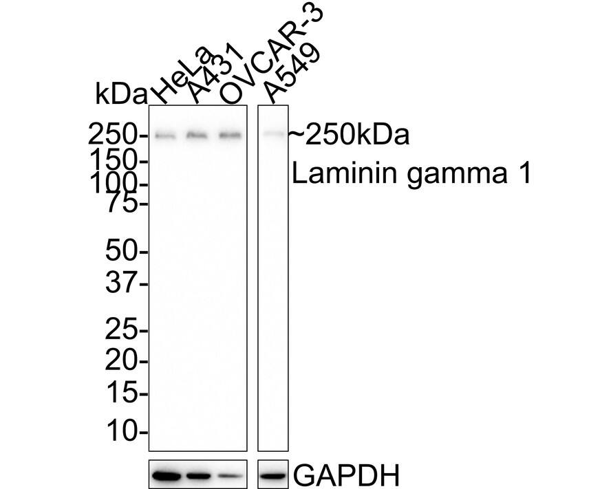 Laminin gamma 1 Antibody (JE40-75)