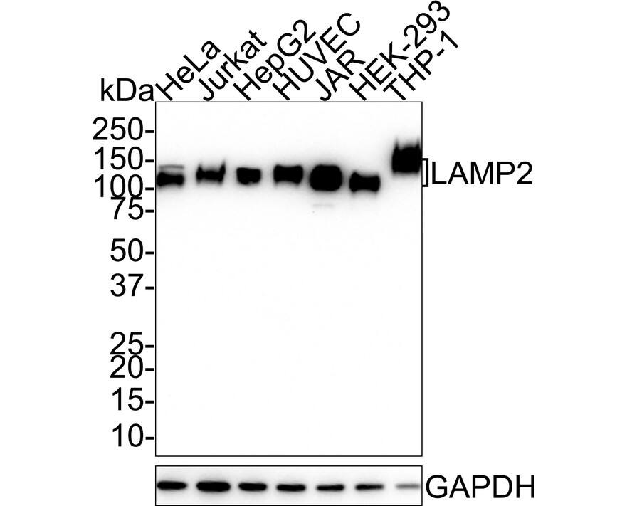 LAMP-2/CD107b Antibody (D3-D8-D3-R)