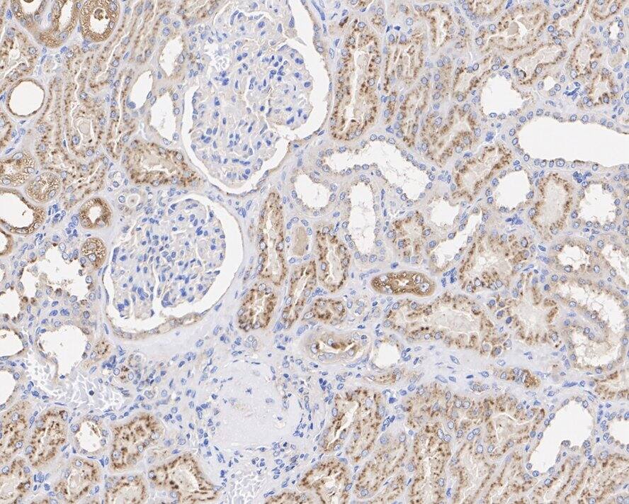 LAMP-2/CD107b Antibody (D3-D8-D3-R)