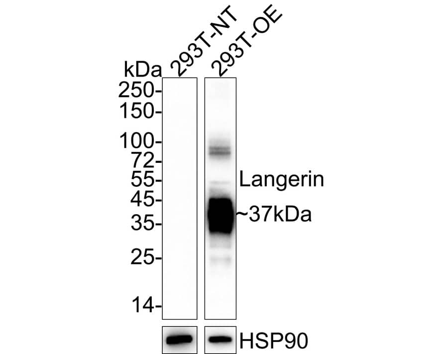 Langerin/CD207 Antibody (PSH04-60)