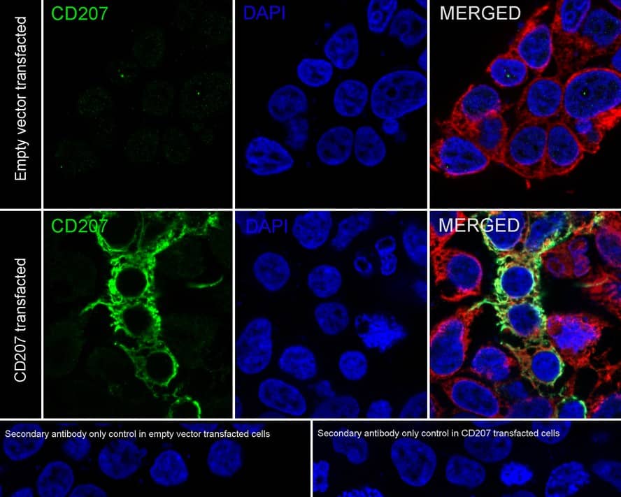 Langerin/CD207 Antibody (PSH04-60)