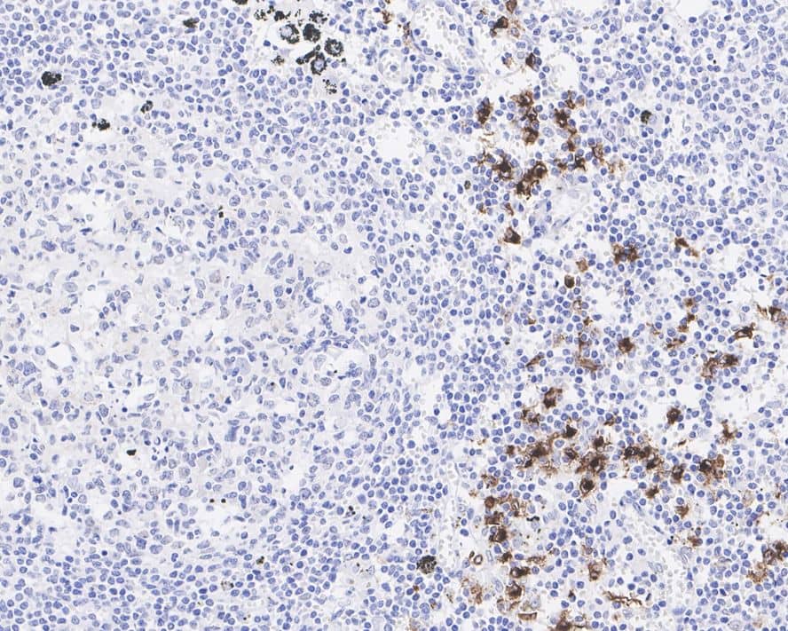 Langerin/CD207 Antibody (PSH04-60)