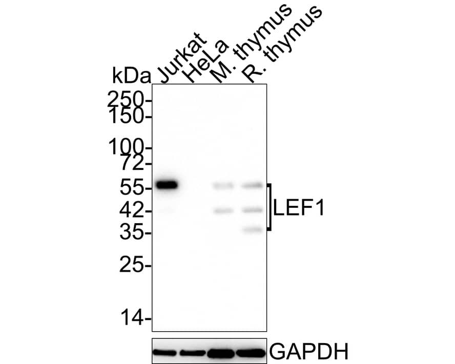 LEF1 Antibody (JE52-28)