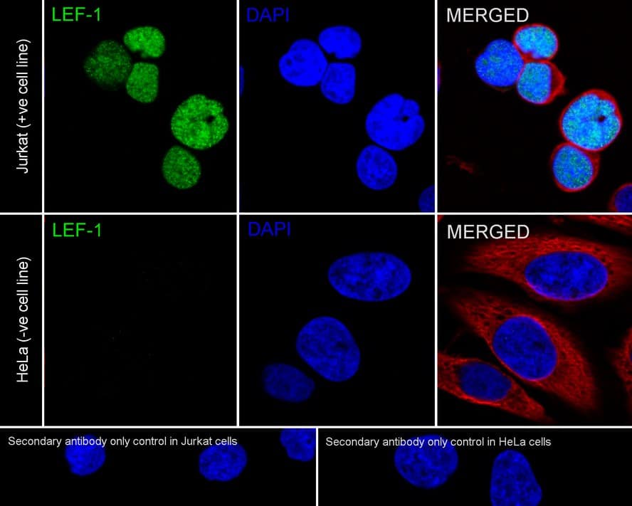 LEF1 Antibody (JE52-28)