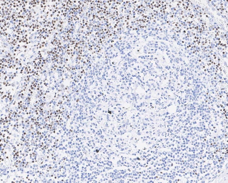 LEF1 Antibody (JE52-28)