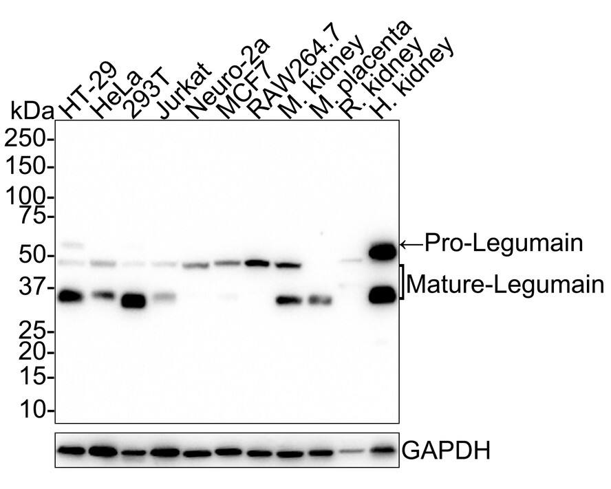 Legumain/Asparaginyl Endopeptidase Antibody (JE35-56)