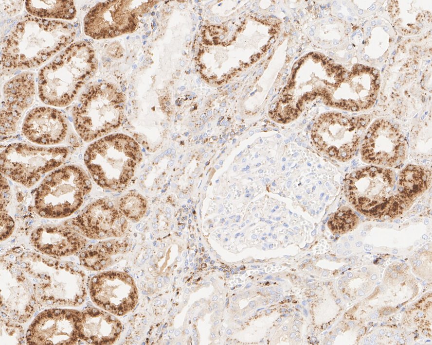Legumain/Asparaginyl Endopeptidase Antibody (JE35-56)