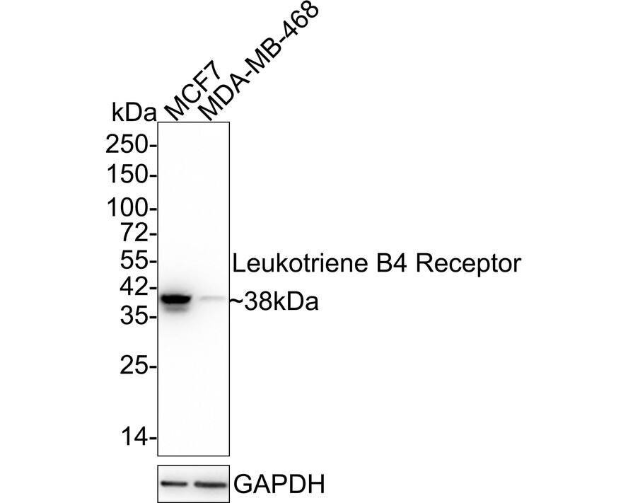 Leukotriene B4 R1 Antibody (JE58-77)