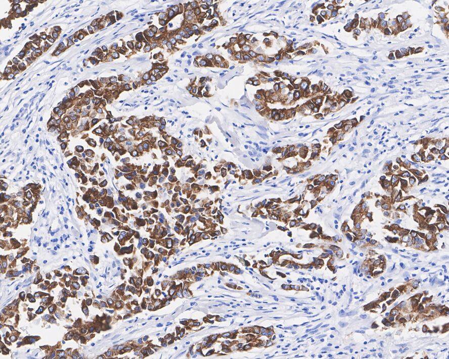 Leukotriene B4 R1 Antibody (JE58-77)