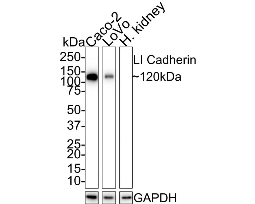 Cadherin-17 Antibody (PD00-49)