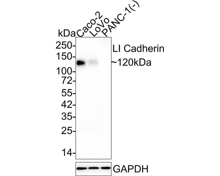 Cadherin-17 Antibody (JE60-34) Western Blot: Cadherin-17 Antibody (JE60-34) [NBP3-32535]