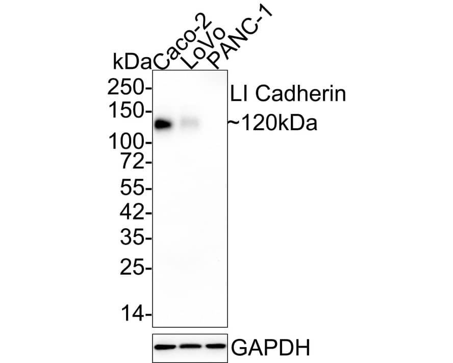 Cadherin-17 Antibody (JE60-34)