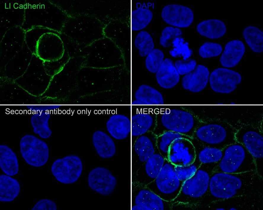 Cadherin-17 Antibody (JE60-34)