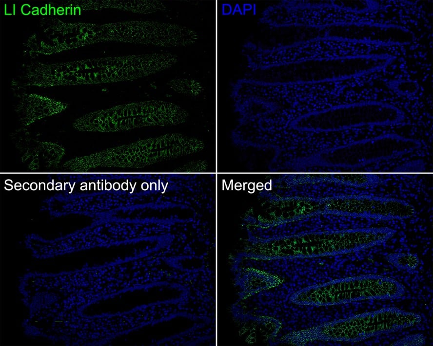 Cadherin-17 Antibody (JE60-34)