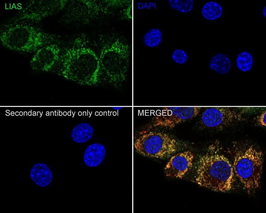 LIAS Antibody (PSH04-04)