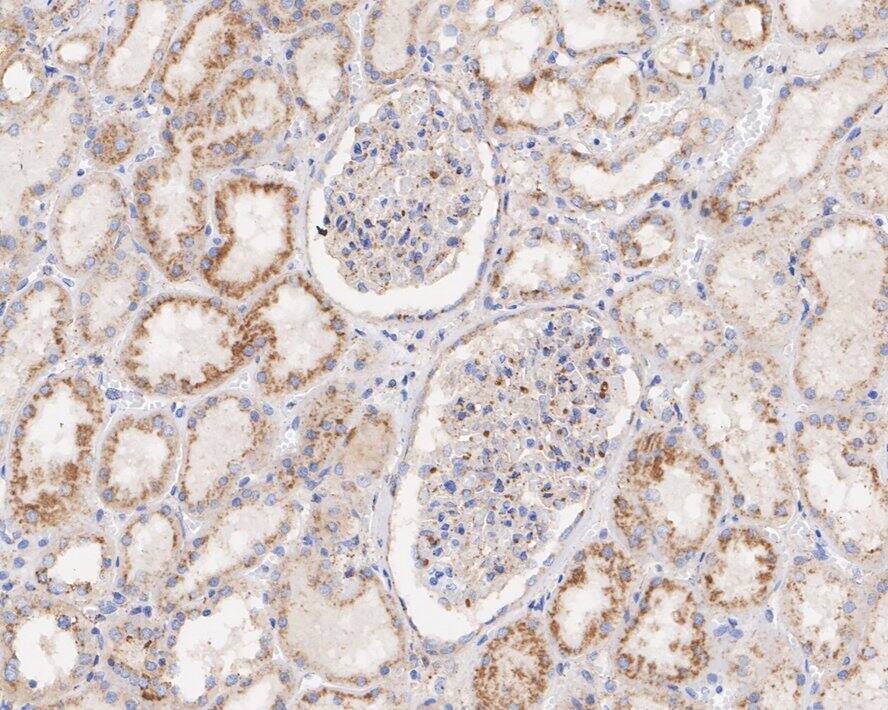 LIMPII/SR-B2 Antibody (PSH03-25)