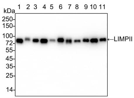 LIMPII/SR-B2 Antibody (PSH03-25)