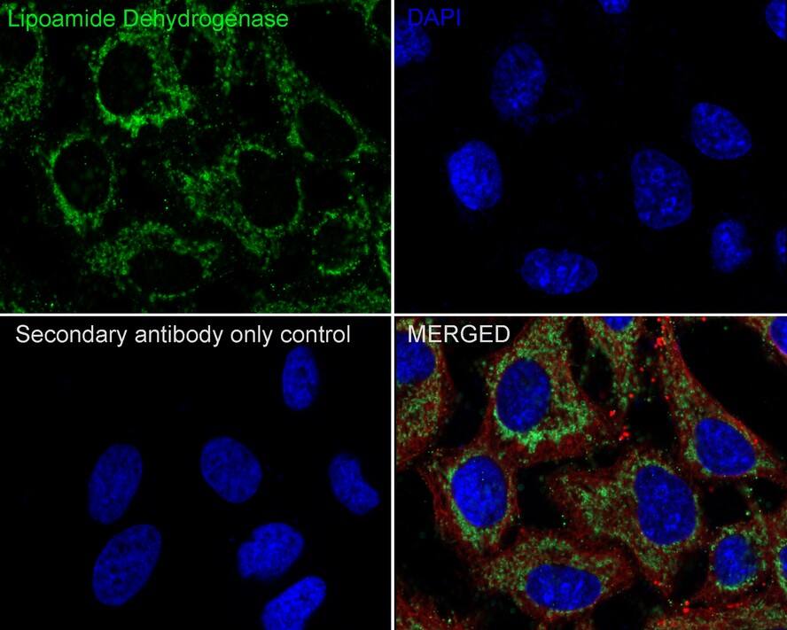 Dihydrolipoamide Dehydrogenase/DLD Antibody (PSH0-83)