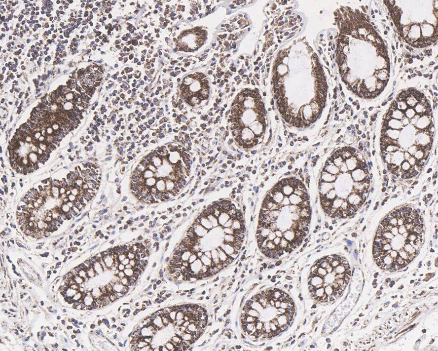 Dihydrolipoamide Dehydrogenase/DLD Antibody (PSH0-83)