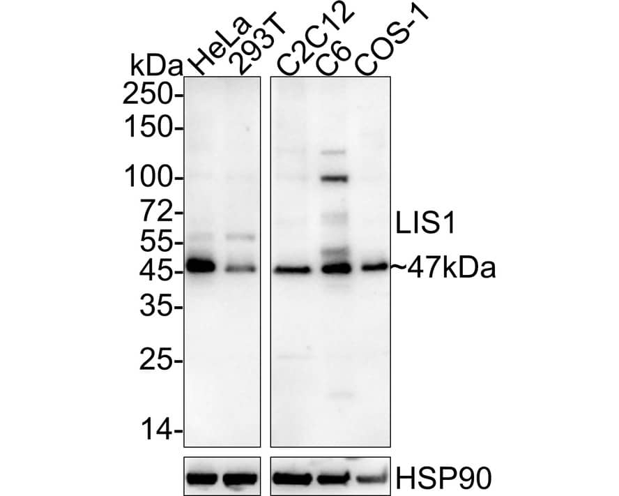 LIS1 Antibody (JE37-43)