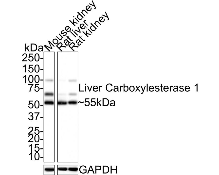 Carboxylesterase 1/CES1 Antibody (JE33-04) Western Blot: Carboxylesterase 1/CES1 Antibody (JE33-04) [NBP3-32541]