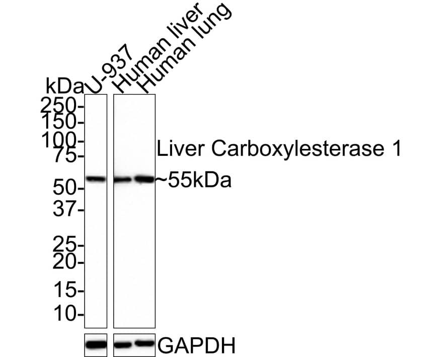 Carboxylesterase 1/CES1 Antibody (JE33-04)