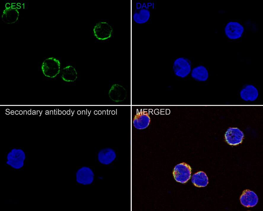 Carboxylesterase 1/CES1 Antibody (JE33-04)