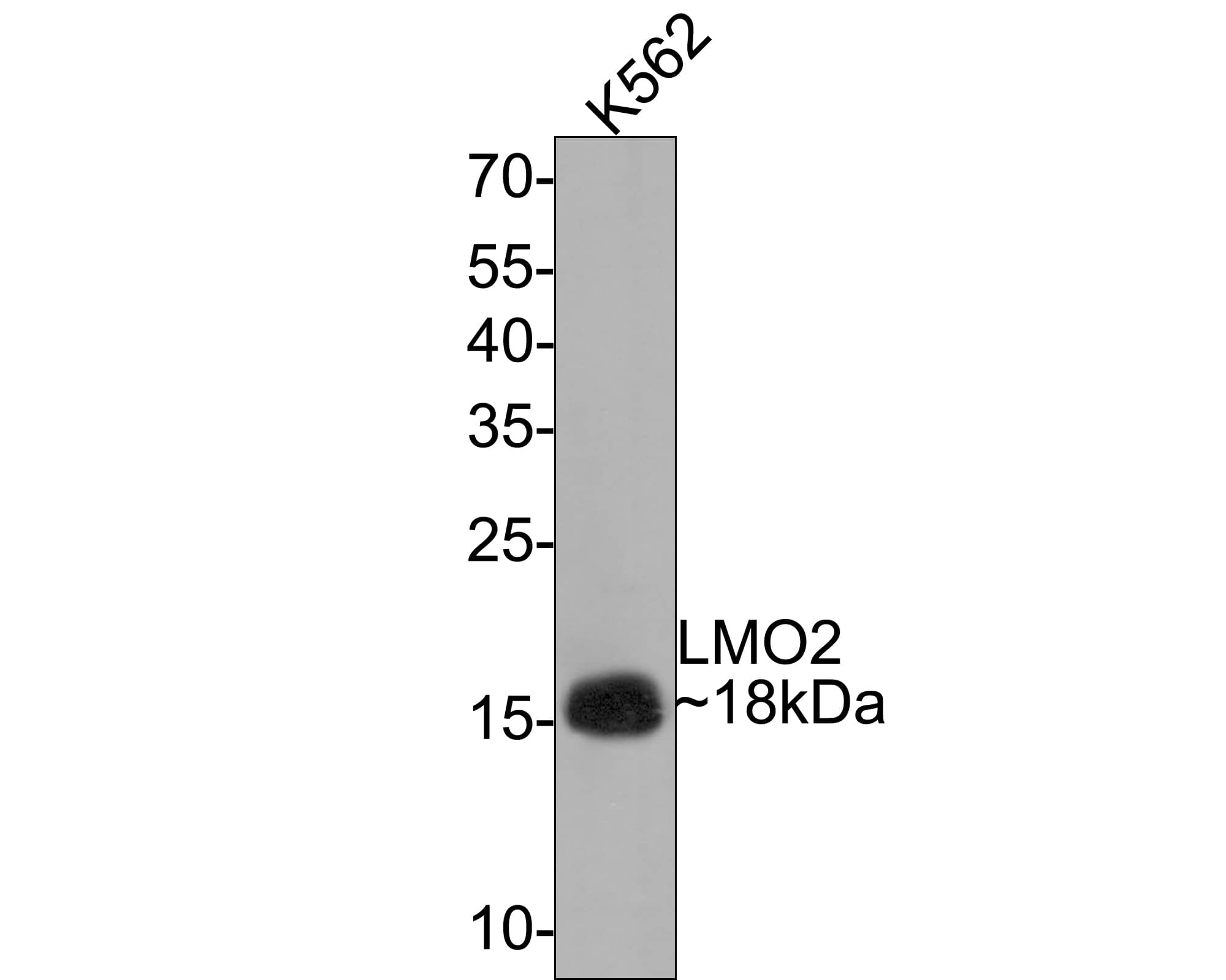 LMO2 Antibody (PD00-25)