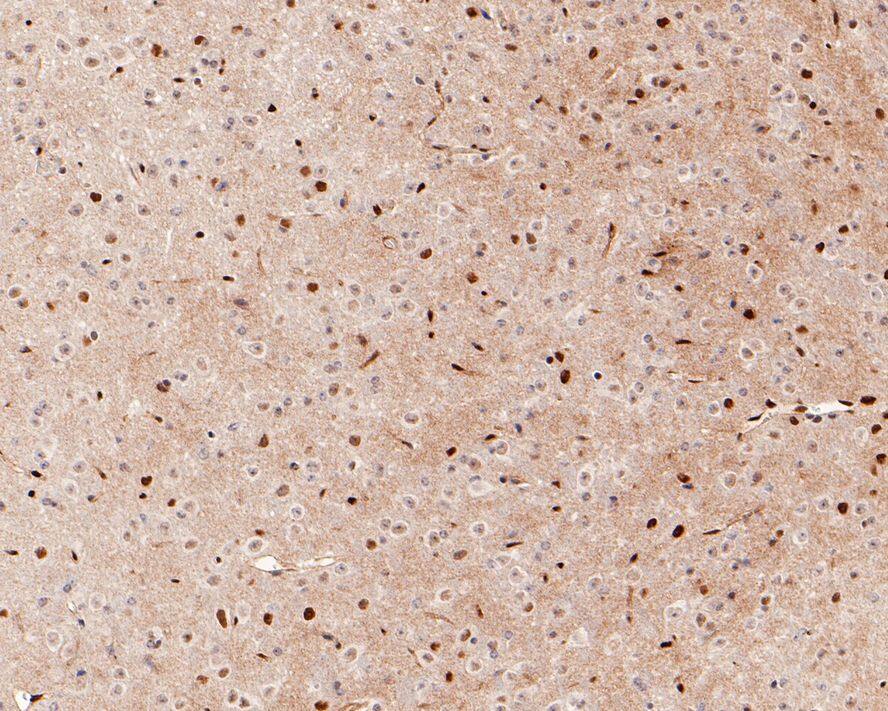 LMO2 Antibody (PD00-25)
