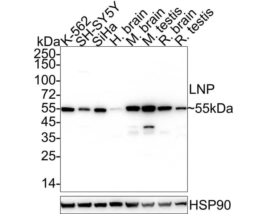 Lunapark Antibody (11-1-R)