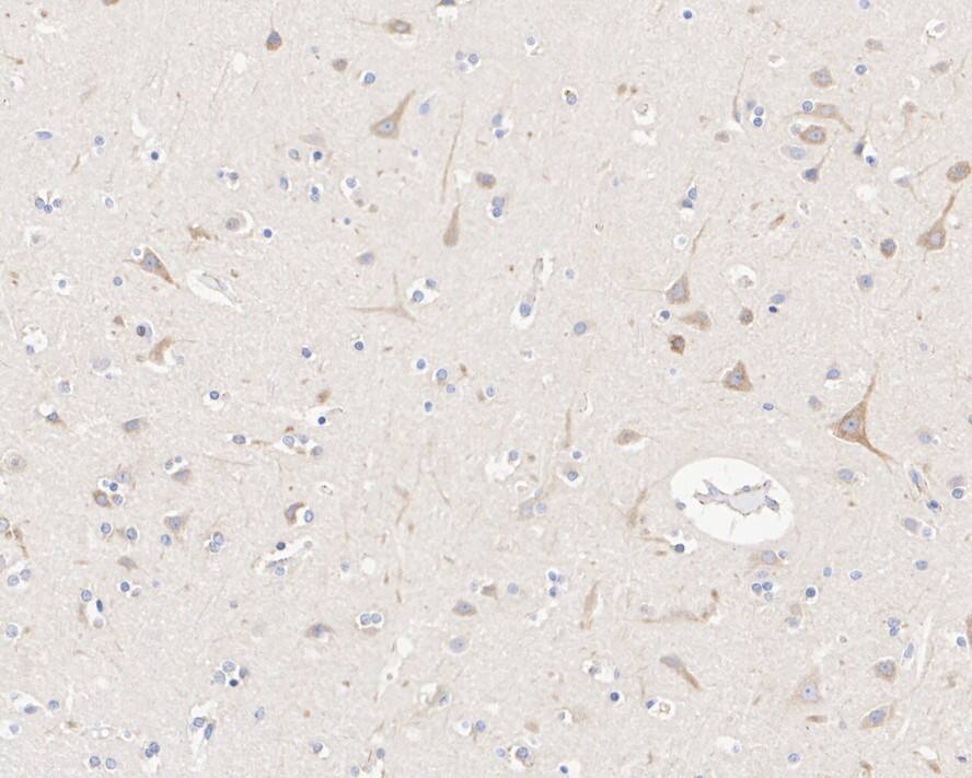 Lunapark Antibody (11-1-R)