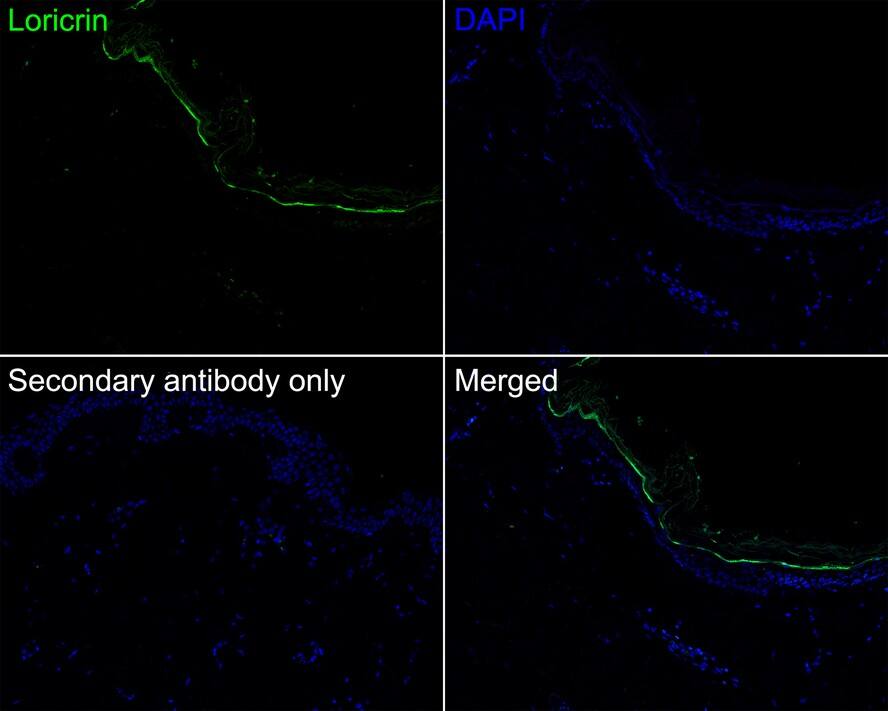 Loricrin Antibody (JE40-03)