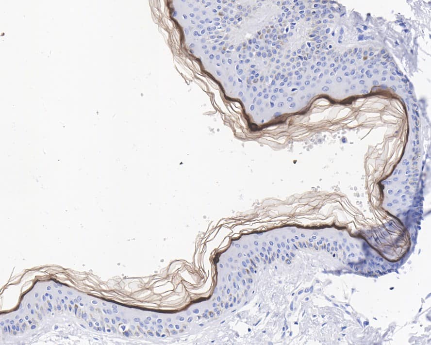 Loricrin Antibody (JE40-03)