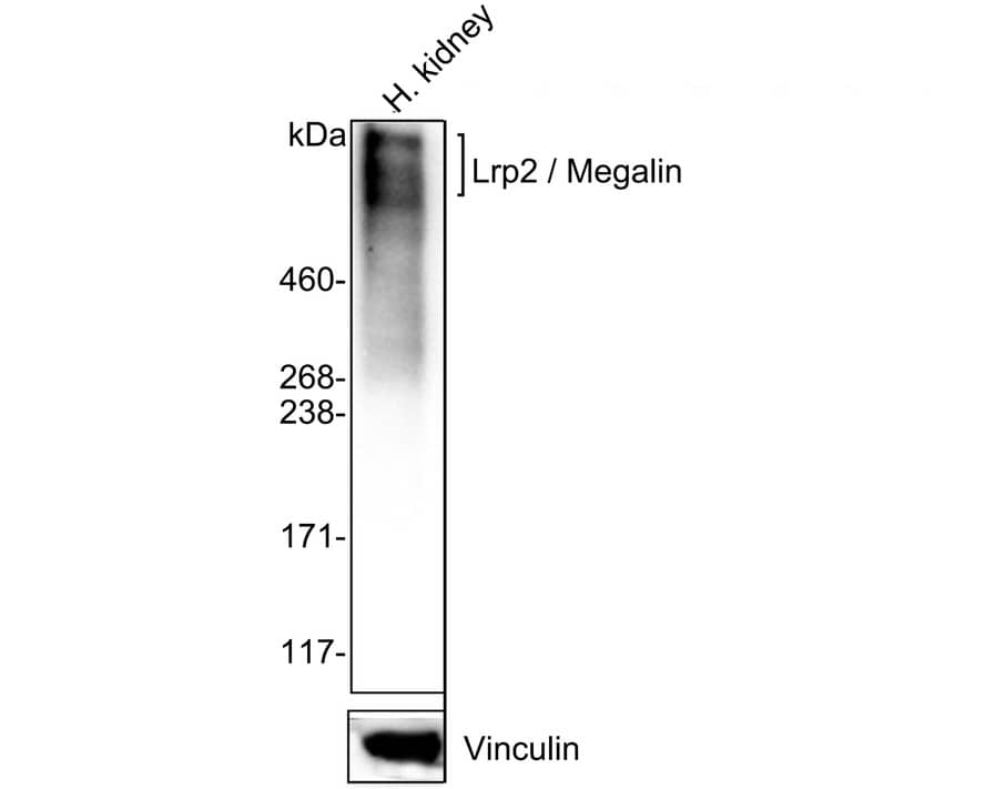 LRP2 Antibody (PSH02-91) Western Blot: LRP2 Antibody (PSH02-91) [NBP3-32545]
